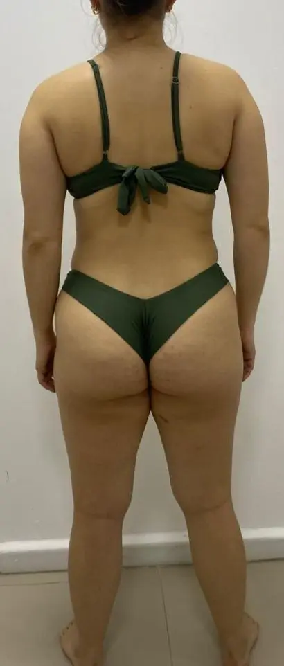Antes